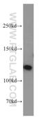 Protein Phosphatase 1 Regulatory Subunit 9B antibody, 55129-1-AP, Proteintech Group, Western Blot image 