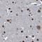 Zinc Finger CCCH-Type Containing 18 antibody, NBP1-82570, Novus Biologicals, Immunohistochemistry paraffin image 