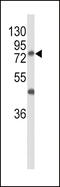 Polypeptide N-acetylgalactosaminyltransferase 3 antibody, 63-838, ProSci, Western Blot image 