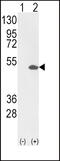 ETS Variant 4 antibody, 62-376, ProSci, Western Blot image 