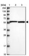 Karyopherin Subunit Alpha 2 antibody, NBP2-38482, Novus Biologicals, Western Blot image 