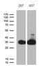 Phosphoglycerate Mutase Family Member 4 antibody, M13144, Boster Biological Technology, Western Blot image 