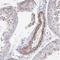 Frizzled-2 antibody, NBP2-33842, Novus Biologicals, Immunohistochemistry paraffin image 