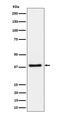 HAUS Augmin Like Complex Subunit 7 antibody, M12338-2, Boster Biological Technology, Western Blot image 