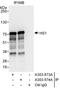 Hematopoietic Cell-Specific Lyn Substrate 1 antibody, A303-573A, Bethyl Labs, Immunoprecipitation image 