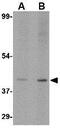 UDP-glucuronic acid/UDP-N-acetylgalactosamine transporter antibody, GTX85390, GeneTex, Western Blot image 