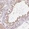 Lebercilin LCA5 Like antibody, NBP2-58163, Novus Biologicals, Immunohistochemistry frozen image 