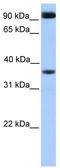 Defective In Cullin Neddylation 1 Domain Containing 4 antibody, TA334981, Origene, Western Blot image 