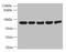 Actin Related Protein T3 antibody, CSB-PA880135LA01HU, Cusabio, Western Blot image 