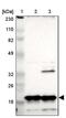 NADH:Ubiquinone Oxidoreductase Subunit B8 antibody, PA5-52011, Invitrogen Antibodies, Western Blot image 