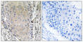 Cerebellin 3 Precursor antibody, abx014344, Abbexa, Western Blot image 