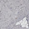 PDIA3 antibody, AMAb90990, Atlas Antibodies, Immunohistochemistry paraffin image 