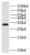 NKAP Domain Containing 1 antibody, FNab01006, FineTest, Western Blot image 