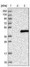 V-Set And Immunoglobulin Domain Containing 2 antibody, PA5-57461, Invitrogen Antibodies, Western Blot image 