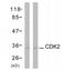 Cyclin-dependent kinase 1 antibody, TA326093, Origene, Western Blot image 