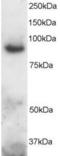 Disintegrin and metalloproteinase domain-containing protein 8 antibody, orb18374, Biorbyt, Western Blot image 
