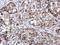 Zinc Finger Protein 599 antibody, GTX119526, GeneTex, Immunohistochemistry paraffin image 