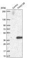 Uncharacterized protein C1orf183 antibody, PA5-55698, Invitrogen Antibodies, Western Blot image 