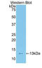 Transcription Factor 20 antibody, LS-C304092, Lifespan Biosciences, Western Blot image 