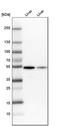 Glutamic--Pyruvic Transaminase antibody, HPA031059, Atlas Antibodies, Western Blot image 
