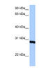 Survival Of Motor Neuron 2, Centromeric antibody, 29-213, ProSci, Enzyme Linked Immunosorbent Assay image 
