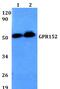 G Protein-Coupled Receptor 152 antibody, PA5-75770, Invitrogen Antibodies, Western Blot image 