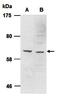 Protein Inhibitor Of Activated STAT 4 antibody, orb66712, Biorbyt, Western Blot image 