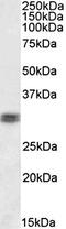 Cone-Rod Homeobox antibody, orb137117, Biorbyt, Western Blot image 