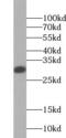 Galectin 3 antibody, FNab03316, FineTest, Western Blot image 