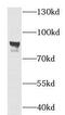 Solute Carrier Family 20 Member 1 antibody, FNab07917, FineTest, Western Blot image 