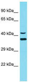 DnaJ Heat Shock Protein Family (Hsp40) Member C18 antibody, TA335382, Origene, Western Blot image 