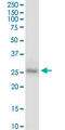 Homeobox protein CDX-1 antibody, LS-C196892, Lifespan Biosciences, Western Blot image 