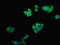 ST8 Alpha-N-Acetyl-Neuraminide Alpha-2,8-Sialyltransferase 2 antibody, LS-C378953, Lifespan Biosciences, Immunofluorescence image 