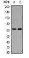 Mannosyl (Beta-1,4-)-Glycoprotein Beta-1,4-N-Acetylglucosaminyltransferase antibody, orb341435, Biorbyt, Western Blot image 