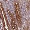 Leucine Rich Melanocyte Differentiation Associated antibody, NBP2-14802, Novus Biologicals, Immunohistochemistry frozen image 