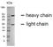 Carcinoembryonic Antigen Related Cell Adhesion Molecule 16 antibody, AM32984PU-N, Origene, Western Blot image 