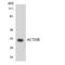 ACTH receptor antibody, LS-C200082, Lifespan Biosciences, Western Blot image 