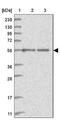 Chromosome 2 Open Reading Frame 42 antibody, NBP2-48620, Novus Biologicals, Western Blot image 
