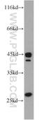 SCO Cytochrome C Oxidase Assembly Protein 2 antibody, 21223-1-AP, Proteintech Group, Western Blot image 