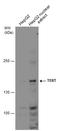 Telomerase Reverse Transcriptase antibody, GTX124242, GeneTex, Western Blot image 