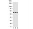 Solute Carrier Family 2 Member 5 antibody, R30827, NSJ Bioreagents, Western Blot image 