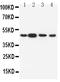 Dopamine Receptor D3 antibody, PA1584, Boster Biological Technology, Western Blot image 