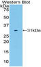 LDL Receptor Related Protein 3 antibody, MBS2005541, MyBioSource, Western Blot image 