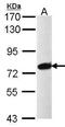 Pre-MRNA Processing Factor 39 antibody, TA309019, Origene, Western Blot image 