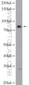 SPT20 Homolog, SAGA Complex Component antibody, 24419-1-AP, Proteintech Group, Western Blot image 