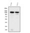 Integrin Subunit Alpha V antibody, A01561-2, Boster Biological Technology, Western Blot image 