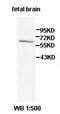Intermediate Filament Family Orphan 1 antibody, orb77917, Biorbyt, Western Blot image 