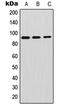 Glycosylphosphatidylinositol Specific Phospholipase D1 antibody, LS-C352256, Lifespan Biosciences, Western Blot image 