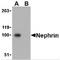 NPHS1 Adhesion Molecule, Nephrin antibody, TA306037, Origene, Western Blot image 