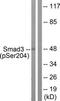 SMAD Family Member 3 antibody, TA312266, Origene, Western Blot image 